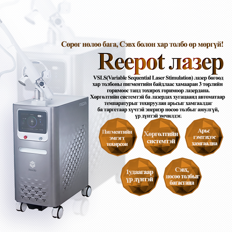 Reepot лазер - VandS Nampo