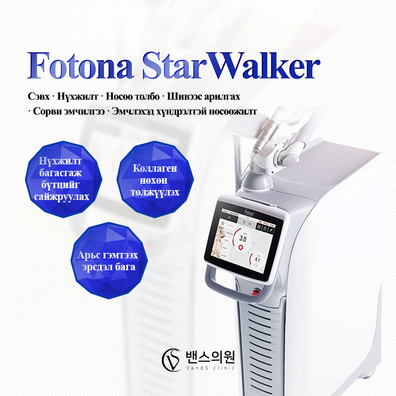 Fotona Star Walker лазер - VandS Nampo