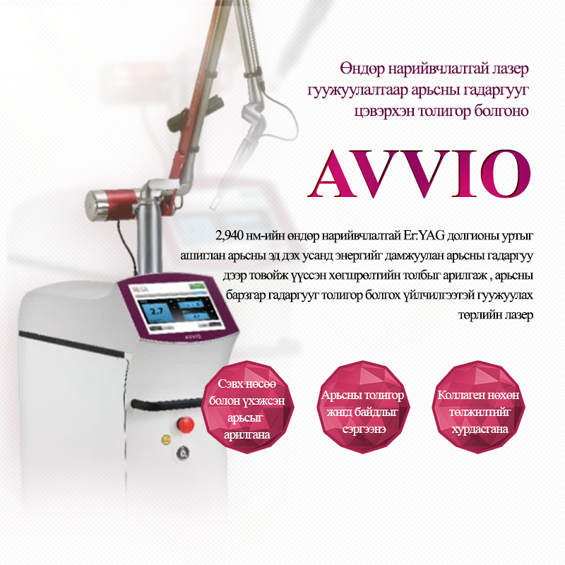 Avvio лазер - VandS Nampo